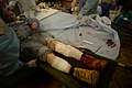 Medical volunteers performing medical aid to the wounded in a makeshift hospital. Clashes in Kyiv, Ukraine. Events of February 18, 2014-2