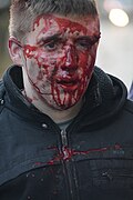 Protester injured during clashes in Kyiv, Ukraine. Events of February 18, 2014